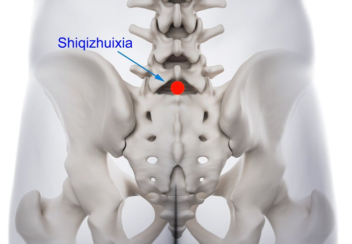 Acupuncture For Sciatica Relief 8-9-26