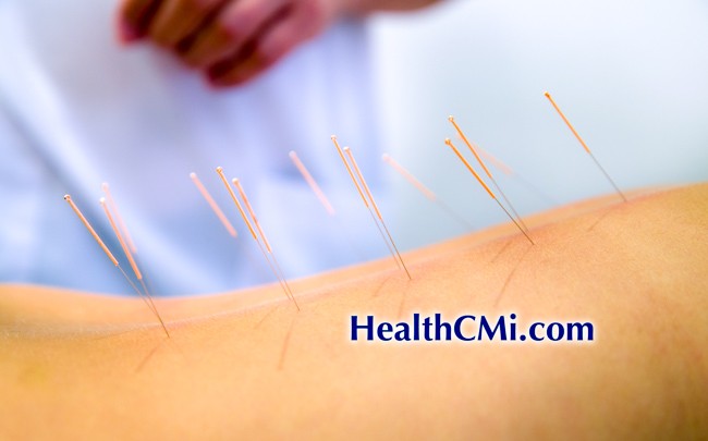 Immune System Acupuncture & Pain Relief 8-23-26