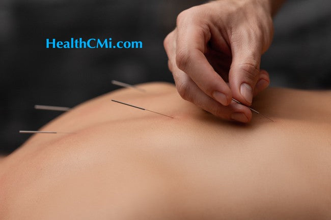 Acupuncture For High Blood Pressure, Tinnitus & Fibromyalgia 8-30-26