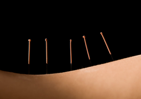 Back Pain Acupuncture Points & Carpal Tunnel Relief 9-20-26